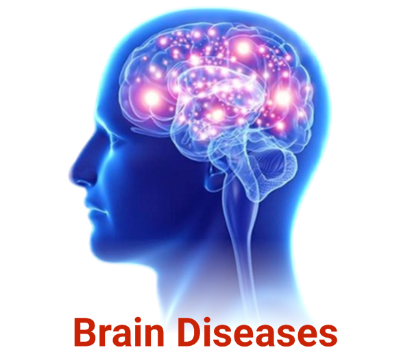 Brain Diseases