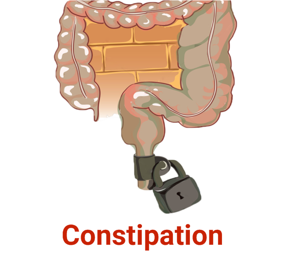 Constipation