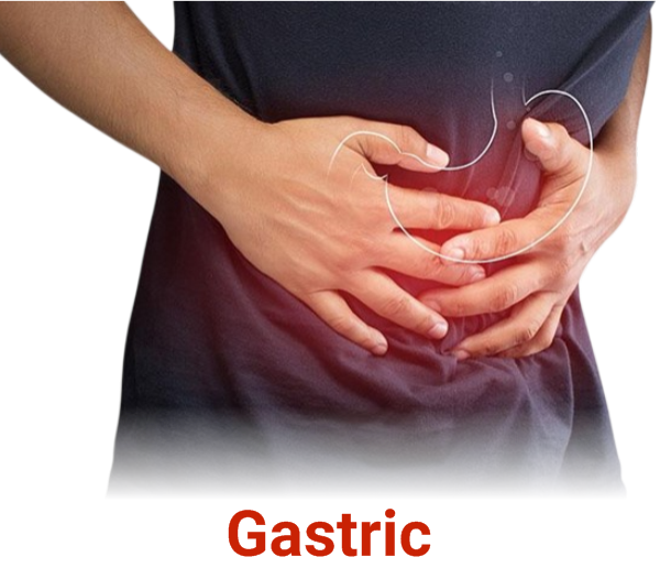 Gastric 2