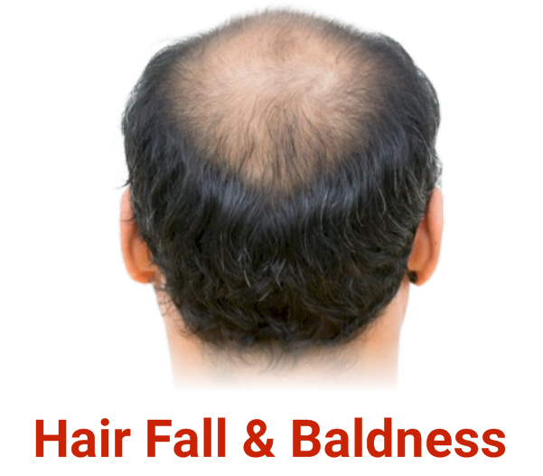 Hair Fall & Baldness
