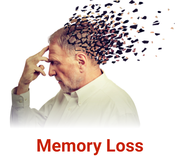 Memory Loss