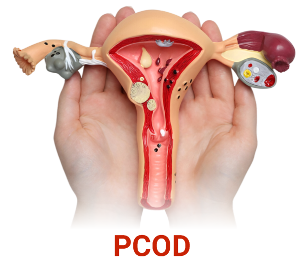PCOD