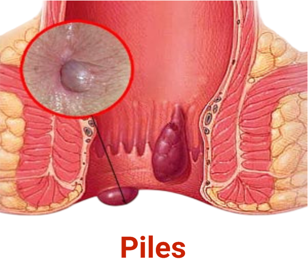 Piles