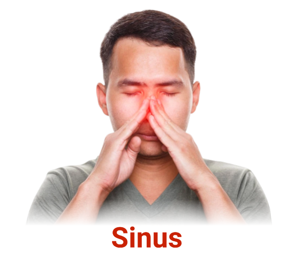 Sinus 2