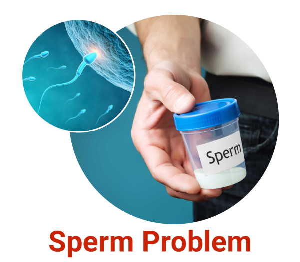Sperm Problem