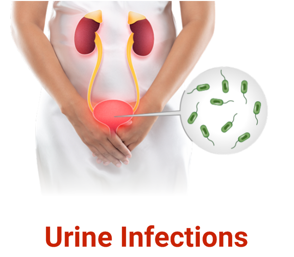 Urine Infections