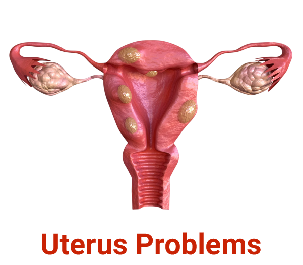 Uterus Problems
